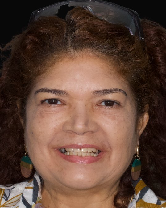 retrato de la paciente sonriendo antes del tratamiento